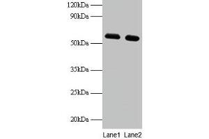 Western blot All lanes: PHGDH antibody at 2 μg/mL Lane 1: EC109 whole cell lysate Lane 2: 293T whole cell lysate Secondary Goat polyclonal to rabbit IgG at 1/15000 dilution Predicted band size: 57 kDa Observed band size: 57 kDa (PHGDH antibody  (AA 2-251))