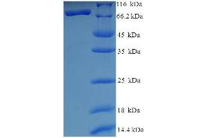 SDS-PAGE (SDS) image for Histone Deacetylase 1 (HDAC1) (AA 1-482), (full length) protein (His-SUMO Tag) (ABIN5709649) (HDAC1 Protein (AA 1-482, full length) (His-SUMO Tag))
