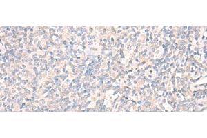 Immunohistochemistry of paraffin-embedded Human tonsil tissue using LILRA2 Polyclonal Antibody at dilution of 1:40(x200) (LILRA2 antibody)