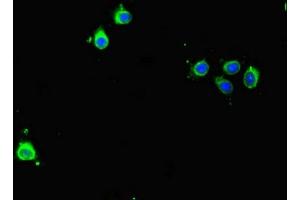 Immunofluorescent analysis of Hela cells using ABIN7145207 at dilution of 1:100 and Alexa Fluor 488-congugated AffiniPure Goat Anti-Rabbit IgG(H+L) (Survivin antibody  (AA 1-130))