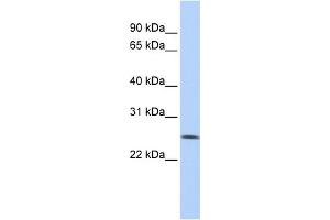WB Suggested Anti-FBXO22 Antibody Titration: 0. (FBXO22 antibody  (Middle Region))