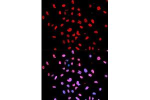Immunofluorescence analysis of U2OS cells using Phospho-Btk-Y223 antibody (ABIN5969941). (BTK antibody  (pTyr223))