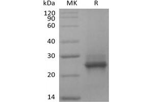 Western Blotting (WB) image for GTPase Kras (KRAS) protein (His tag) (ABIN7319807) (K-RAS Protein (His tag))