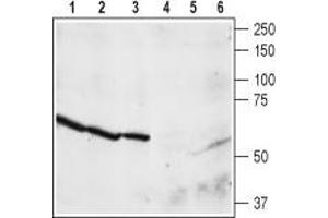 Western blot analysis of rat brain membrane (lanes 1 and 4), cortex (lanes 2 and 5), and hippocampus (lanes 3 and 6) lysates: - 1,2,3. (NPY4R antibody  (C-Term, Intracellular))