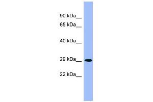WB Suggested Anti-PHYH Antibody Titration: 0. (PHYH antibody  (Middle Region))