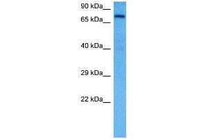 Host:  Rat  Target Name:  KCND3  Sample Tissue:  Rat Liver  Antibody Dilution:  1ug/ml (KCND3 antibody  (Middle Region))