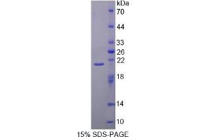 SDS-PAGE analysis of Mouse CAPN1 Protein.