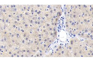 Detection of REV1 in Human Liver Tissue using Polyclonal Antibody to REV1 Homolog (REV1) (REV1 antibody  (AA 834-976))