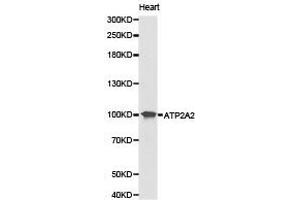 Western Blotting (WB) image for anti-ATPase, Ca++ Transporting, Cardiac Muscle, Slow Twitch 2 (ATP2A2) antibody (ABIN1871156) (ATP2A2 antibody)