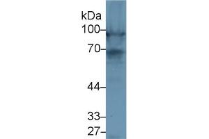 Western Blot; Sample: Rat Heart lysate; Primary Ab: 1µg/ml Rabbit Anti-Rat NEXN Antibody Second Ab: 0. (NEXN antibody  (AA 214-455))