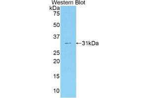 Western blot analysis of the recombinant protein. (Coagulation Factor V antibody  (AA 364-611))