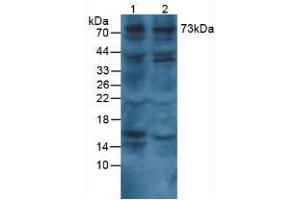 Figure. (COL8A1 antibody  (AA 575-743))