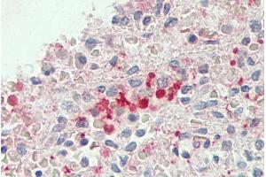 ABIN1782177 (5µg/ml) staining of paraffin embedded Human Spleen. (BLVRB antibody  (AA 38-49))