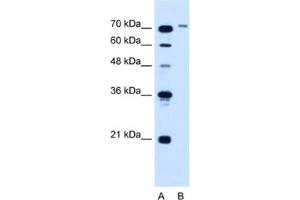 Western Blotting (WB) image for anti-Solute Carrier Organic Anion Transporter Family, Member 6A1 (SLCO6A1) antibody (ABIN2462780) (SLCO6A1 antibody)