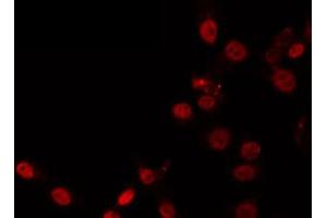 ABIN6266874 staining HeLa by IF/ICC. (ZNF337 antibody)