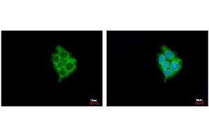 ICC/IF Image MIA3 antibody [N1], N-term detects MIA3 protein at Cytoplasm by immunofluorescent analysis. (MIA3 antibody  (N-Term))