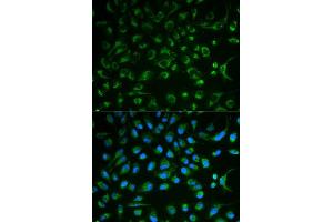 Immunofluorescence analysis of MCF7 cell using NT5E antibody. (CD73 antibody  (AA 290-550))