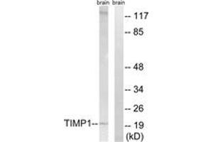 Western blot analysis of extracts from rat brain cells, using TIMP1 Antibody. (TIMP1 antibody  (AA 61-110))
