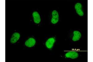 Immunofluorescence of monoclonal antibody to SMARCD2 on HeLa cell. (SMARCD2 antibody  (AA 398-474))