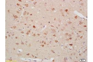 Formalin-fixed and paraffin embedded rat brain labeled with Anti-Gastrin receptor Polyclonal Antibody, Unconjugated (ABIN734318) at 1:200 followed by conjugation to the secondary antibody and DAB staining