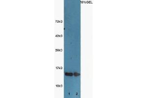 Lane 1:Huh7 lysates Lane 2: A549 lysates probed with Rabbit  Anti-Histone H3 (acetyl K9) Polyclonal Antibody, Unconjugated (ABIN703946) at 1:300 overnight at 4 °C. (Histone 3 antibody  (H3K9ac))