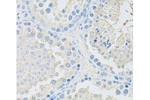 Immunohistochemistry of paraffin-embedded Mouse testis using SLC2A9 Polyclonal Antibody at dilution of 1:100 (40x lens). (SLC2A9 antibody)