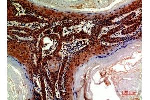 Immunohistochemical analysis of paraffin-embedded human-skin, antibody was diluted at 1:200 (ADAMTS18 antibody  (AA 1030-1110))