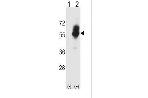 Western blot analysis of SLC7A1 using rabbit polyclonal SLC7A1 Antibody using 293 cell lysates (2 ug/lane) either nontransfected (Lane 1) or transiently transfected (Lane 2) with the SLC7A1 gene. (SLC7A1 antibody  (C-Term))