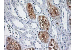 Immunohistochemical staining of paraffin-embedded Human Kidney tissue using anti-SOCS3 mouse monoclonal antibody. (SOCS3 antibody)