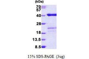 Surfeit 2 (SURF2) (AA 1-256) protein (His tag)