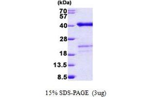 SDS-PAGE (SDS) image for Surfeit 2 (SURF2) (AA 1-256) protein (His tag) (ABIN5852983) (SURF2 Protein (AA 1-256) (His tag))