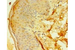 Immunohistochemistry of paraffin-embedded human skin tissue using ABIN7144984 at dilution of 1:100 (DDX39 antibody  (AA 178-427))
