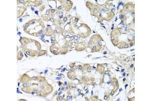 Immunohistochemistry of paraffin-embedded Human stomach using BCS1L Polyclonal Antibody at dilution of 1:100 (40x lens). (BCS1L antibody)