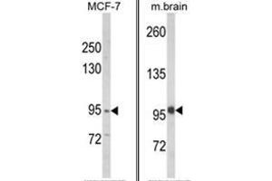 (LEFT) Western blot analysis of VPS53 Antibody (N-term) in MCF-7 cell line lysates (35ug/lane). (VPS53 antibody  (N-Term))