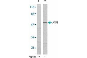 Western blot analysis of extract from LoVo cells using ATF2 polyclonal antibody  .