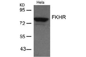 Image no. 2 for anti-Forkhead Box O1 (FOXO1) (AA 254-258) antibody (ABIN197335) (FOXO1 antibody  (AA 254-258))
