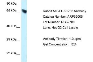 Western Blotting (WB) image for anti-Carboxylesterase 3 (CES3) (C-Term) antibody (ABIN2788984) (CES3 antibody  (C-Term))
