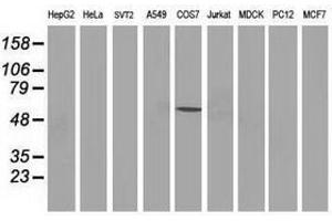 Image no. 3 for anti-Tumor Protein P53 (TP53) antibody (ABIN1499970) (p53 antibody)