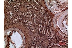 Immunohistochemistry (IHC) image for anti-serpin Peptidase Inhibitor, Clade A (Alpha-1 Antiproteinase, Antitrypsin), Member 3 (SERPINA3) (Internal Region) antibody (ABIN6287251)