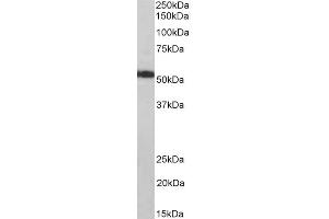 Western Blotting (WB) image for anti-ATP Synthase, H+ Transporting, Mitochondrial F1 Complex, alpha Subunit 1, Cardiac Muscle (ATP5A1) antibody (ABIN5910982) (ATP5A1 antibody)