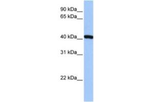Western Blotting (WB) image for anti-FtsJ RNA Methyltransferase Homolog 1 (FTSJ1) antibody (ABIN2463265)