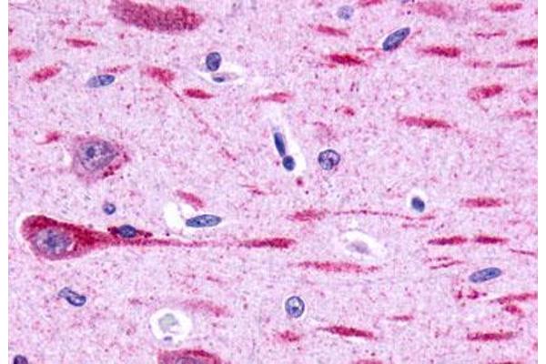 GPR162 antibody  (Extracellular Domain)