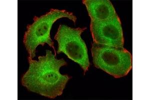 Immunohistochemical analysis of paraffin-embedded human skeletal muscle section using SMAD1 antibody (SMAD1 antibody  (AA 163-196))