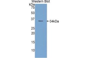 Western blot analysis of the recombinant protein. (ECE1 antibody  (AA 326-577))