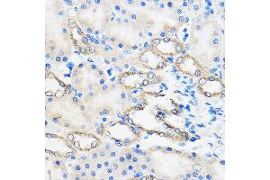 Immunohistochemistry of paraffin-embedded Rat kidney using /// Rabbit pAb (ABIN7265627) at dilution of 1:50 (40x lens). (ANT1+ANT2+ANT3+ANT4 (C-Term) antibody)