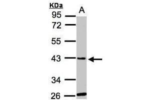 WB Image Sample(30 ug whole cell lysate) A:Hep G2 , 10% SDS PAGE antibody diluted at 1:1000 (GLYATL1 antibody)