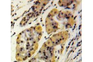 Used in DAB staining on fromalin fixed paraffin-embedded Stomach tissue (MMP2 antibody  (AA 110-660))