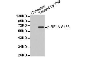 Western blot analysis of extracts from Hela cells, using Phospho-RELA-S468 antibody. (NF-kB p65 antibody  (pSer468))