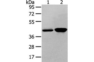 Western Blotting (WB) image for anti-Vasohibin 2 (VASH2) antibody (ABIN5958782)