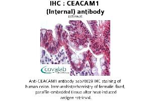 Image no. 1 for anti-Carcinoembryonic Antigen-Related Cell Adhesion Molecule 1 (CEACAM1) (Internal Region) antibody (ABIN1732947) (CEACAM1 antibody  (Internal Region))